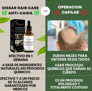 ¡TRATAMIENTO ANTICAIDA DEL CABELLO! - RECUPERALO YA