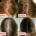 ¡TRATAMIENTO ANTICAIDA DEL CABELLO! - RECUPERALO YA